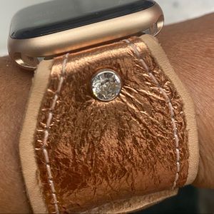 Brand New Sparkl Custom Apple Watch Band